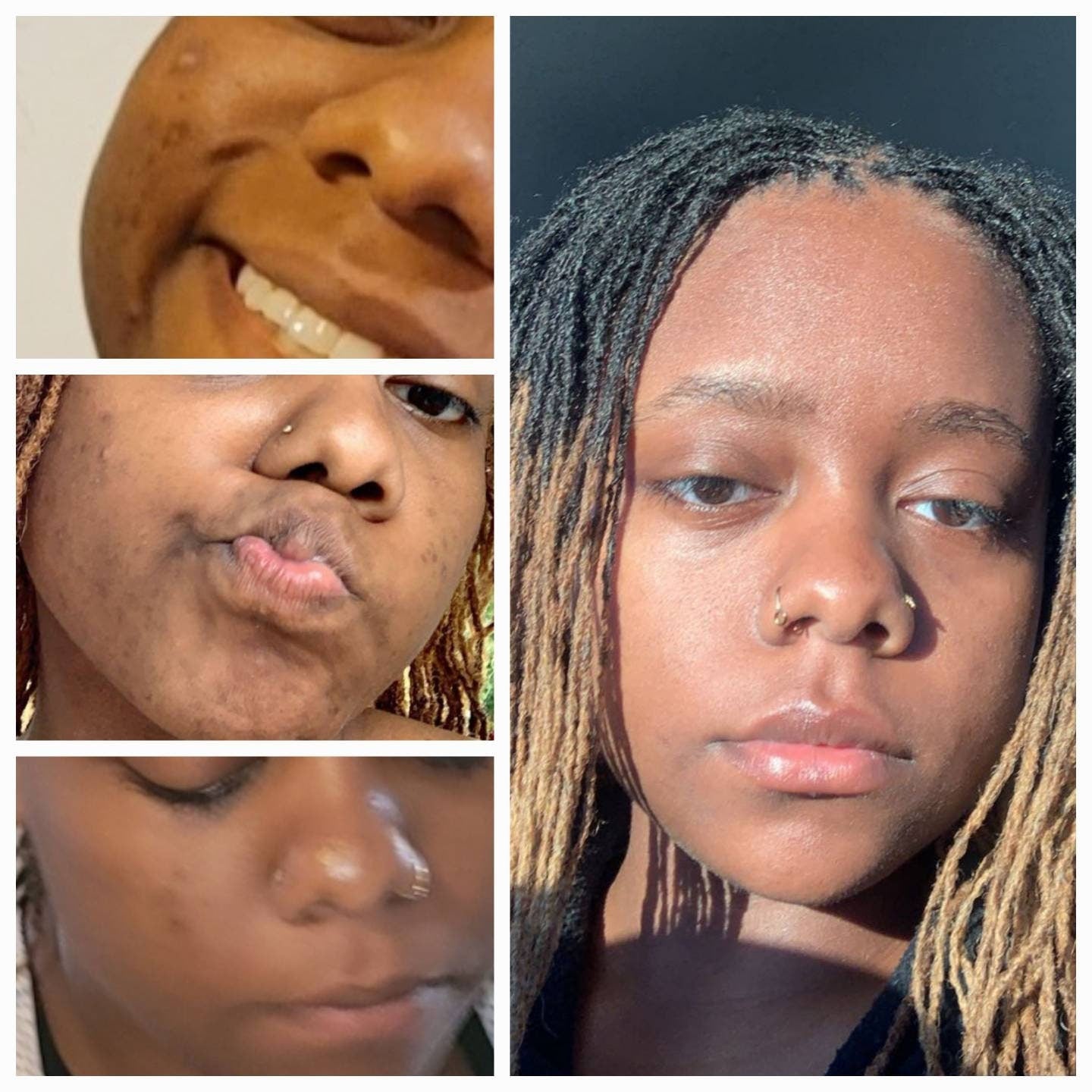 (GLARE)-Turmeric +Niacinamide face set